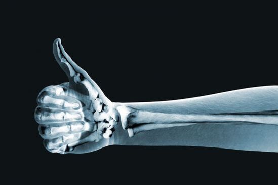 X-ray aron mahibal-an ang kasakit sa mga lutahan sa mga tudlo