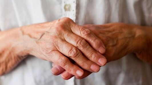 rheumatoid arthritis isip usa ka hinungdan sa kasakit sa mga lutahan sa mga tudlo
