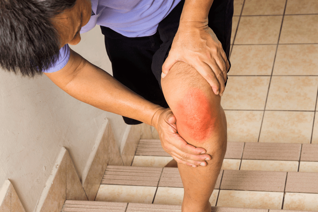 joint pain tungod sa arthrosis
