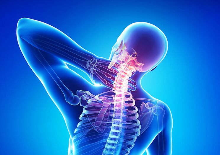 Ang spinal osteochondrosis usa ka sakit nga nakaapekto sa articular cartilage ug vertebrae.