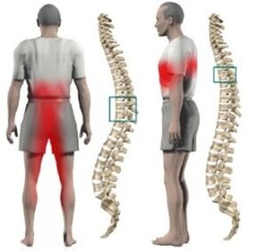 Protrusions sa dugokan